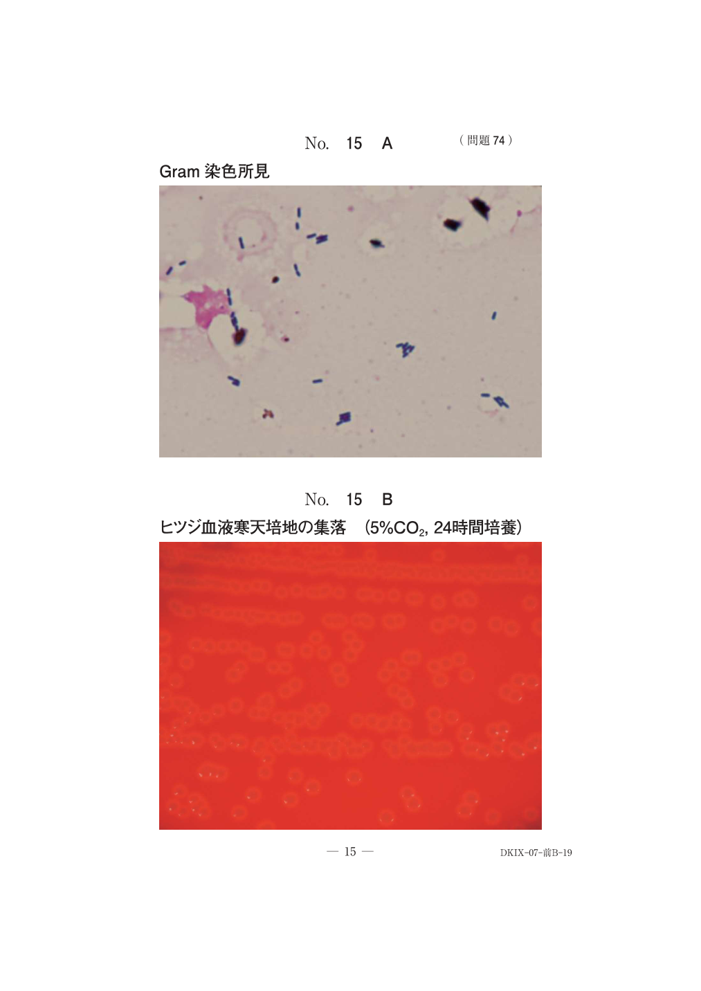 第71回午前問74の公式原図。判読用の原画像。