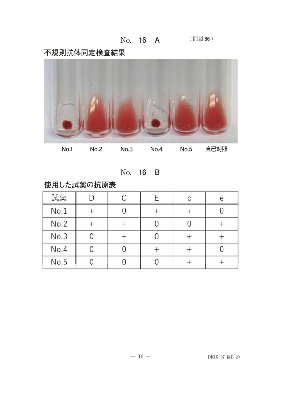 問86の図表1