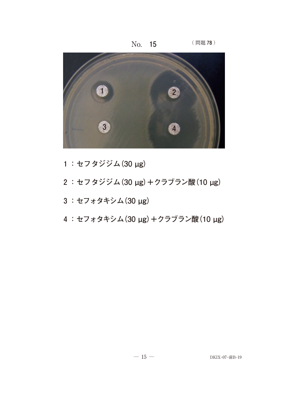 別冊No.15、E. coliの薬剤耐性確認試験。クラブラン酸併用のディスク2・4で、各単剤1・3より阻止円が拡大。