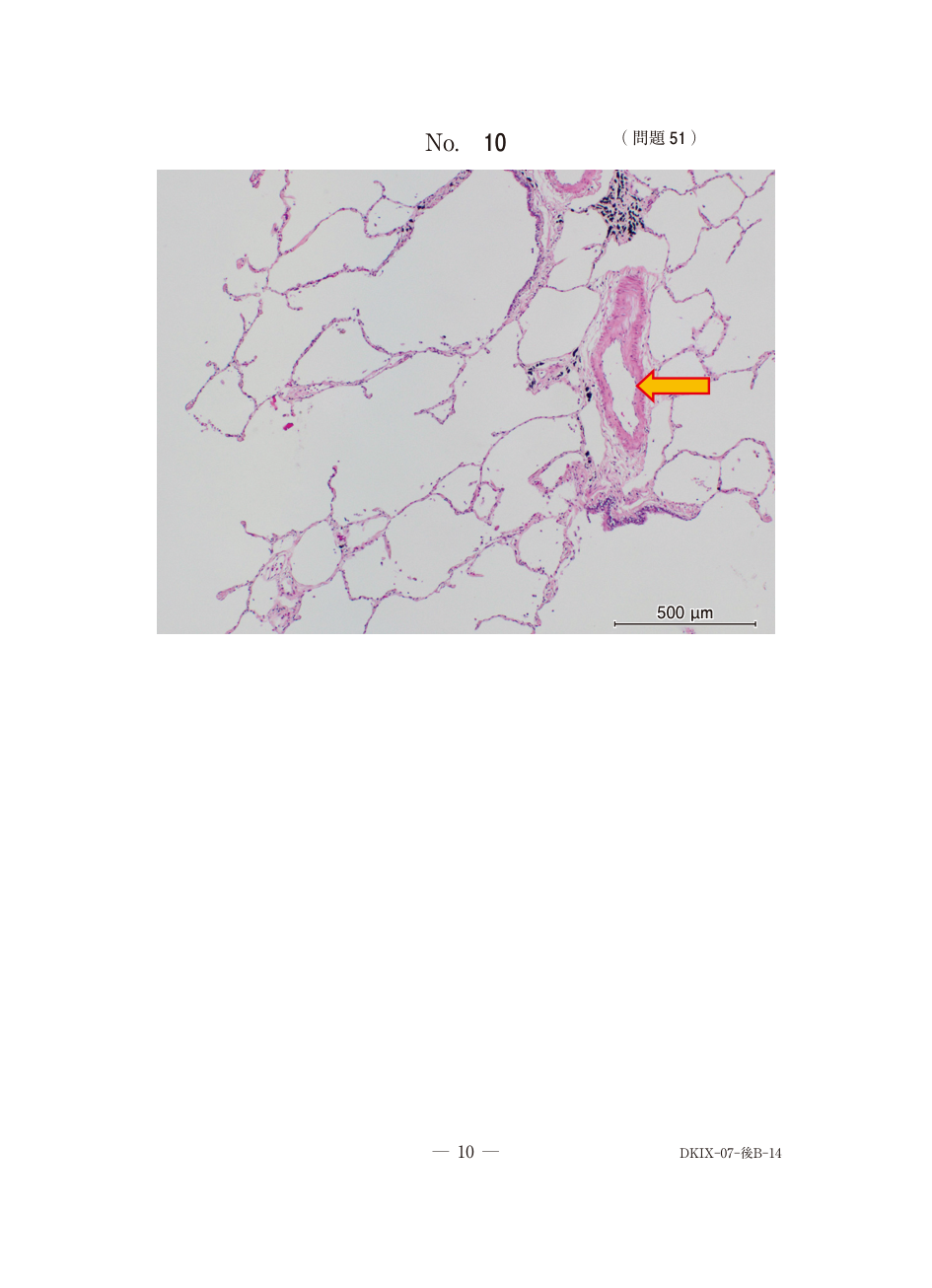 問51の図表1