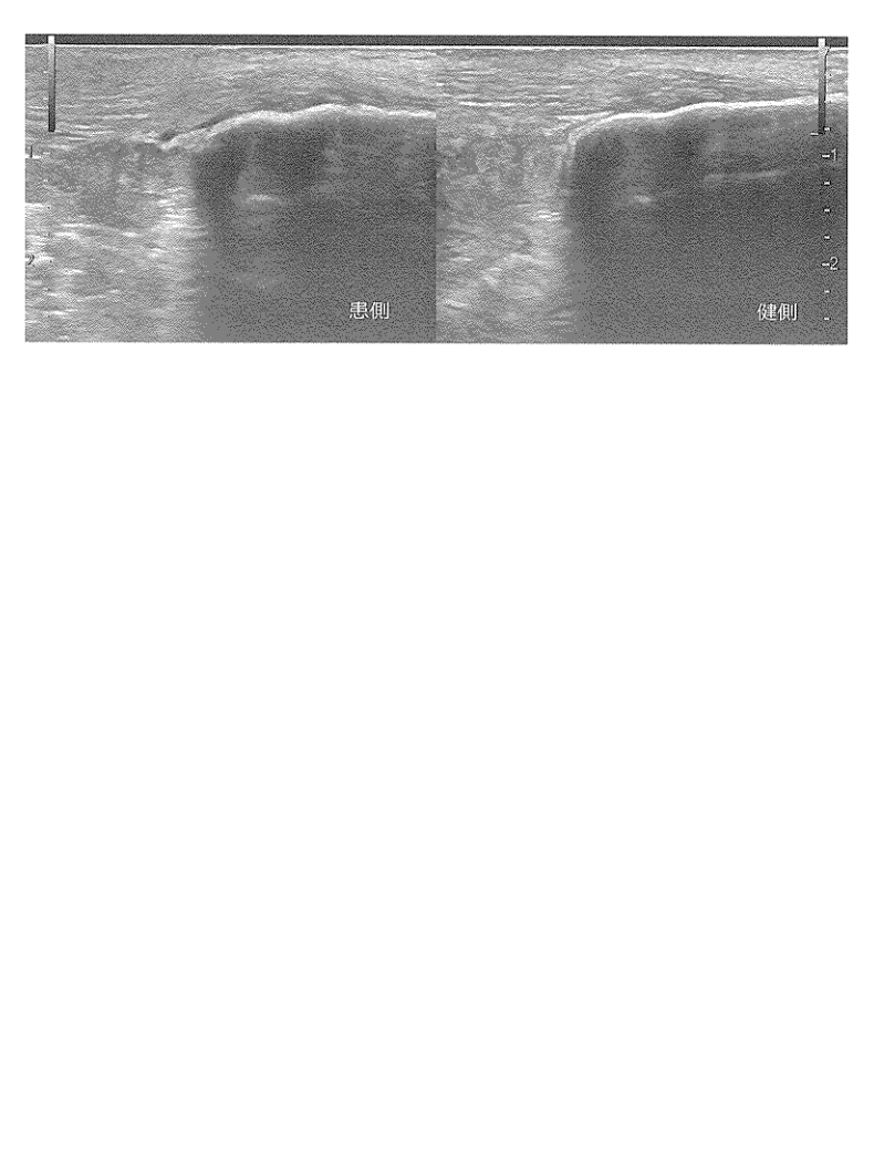 第33回午後 別冊 No.8(問題122)(公式原本から切り出し)