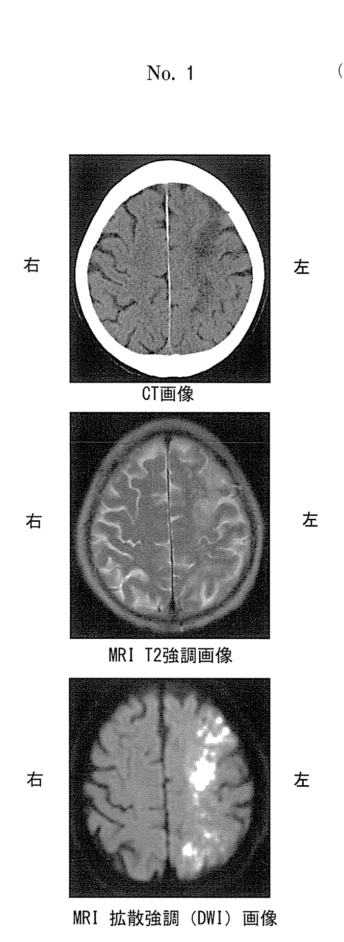 第34回午後問15の公式問題図(公式原本から切り出し)