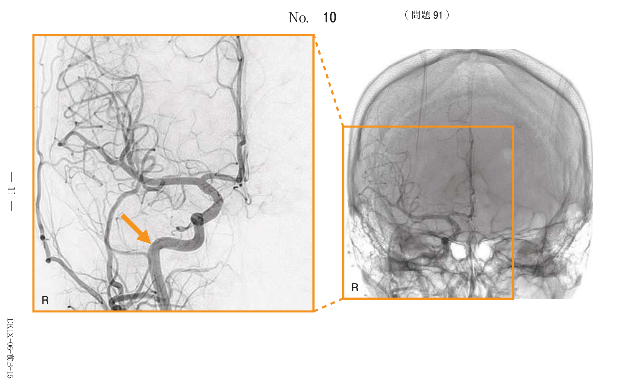 第77回診療放射線技師国家試験 午前 問91の原典図1