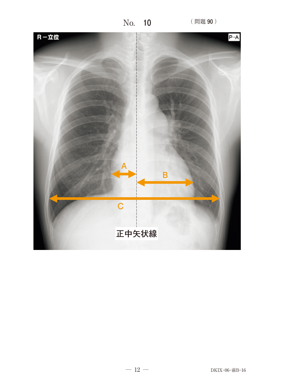第78回午前問90の公式別冊図
