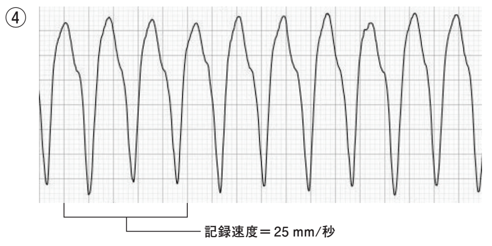 問13の図表4