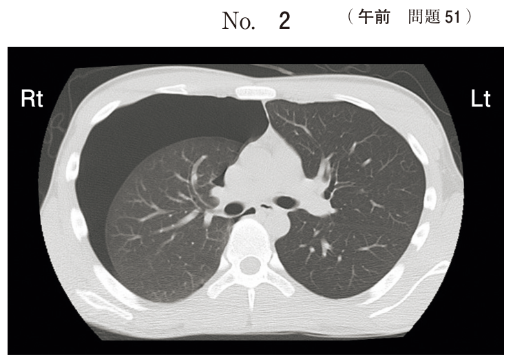 問51の図表1