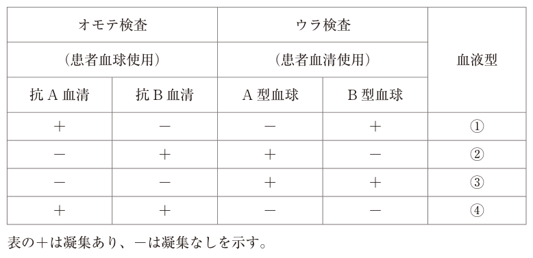 ABO式血液型検査表。列は抗A血清、抗B血清、A型血球、B型血球。①は+--+、②は-++-、③は--++、④は++--。+は凝集あり、-は凝集なし。