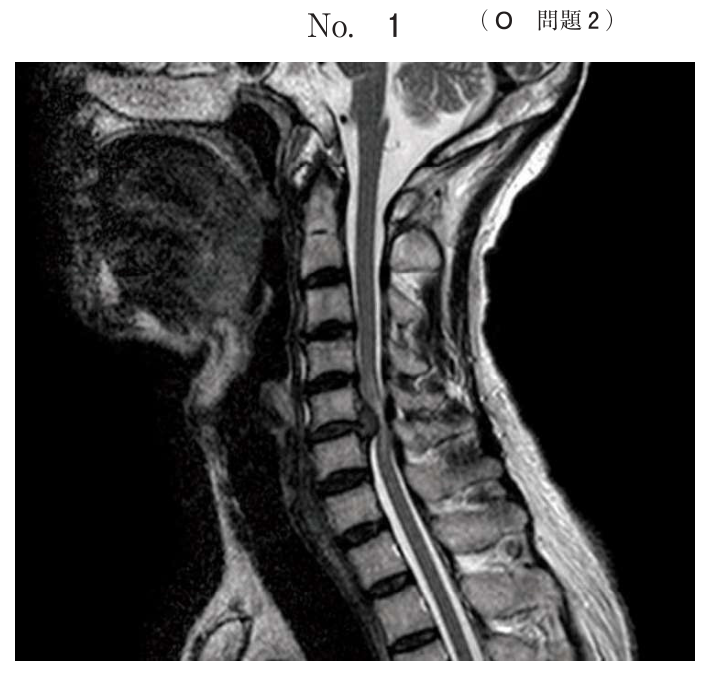 原本別冊No.1：頸椎MRI