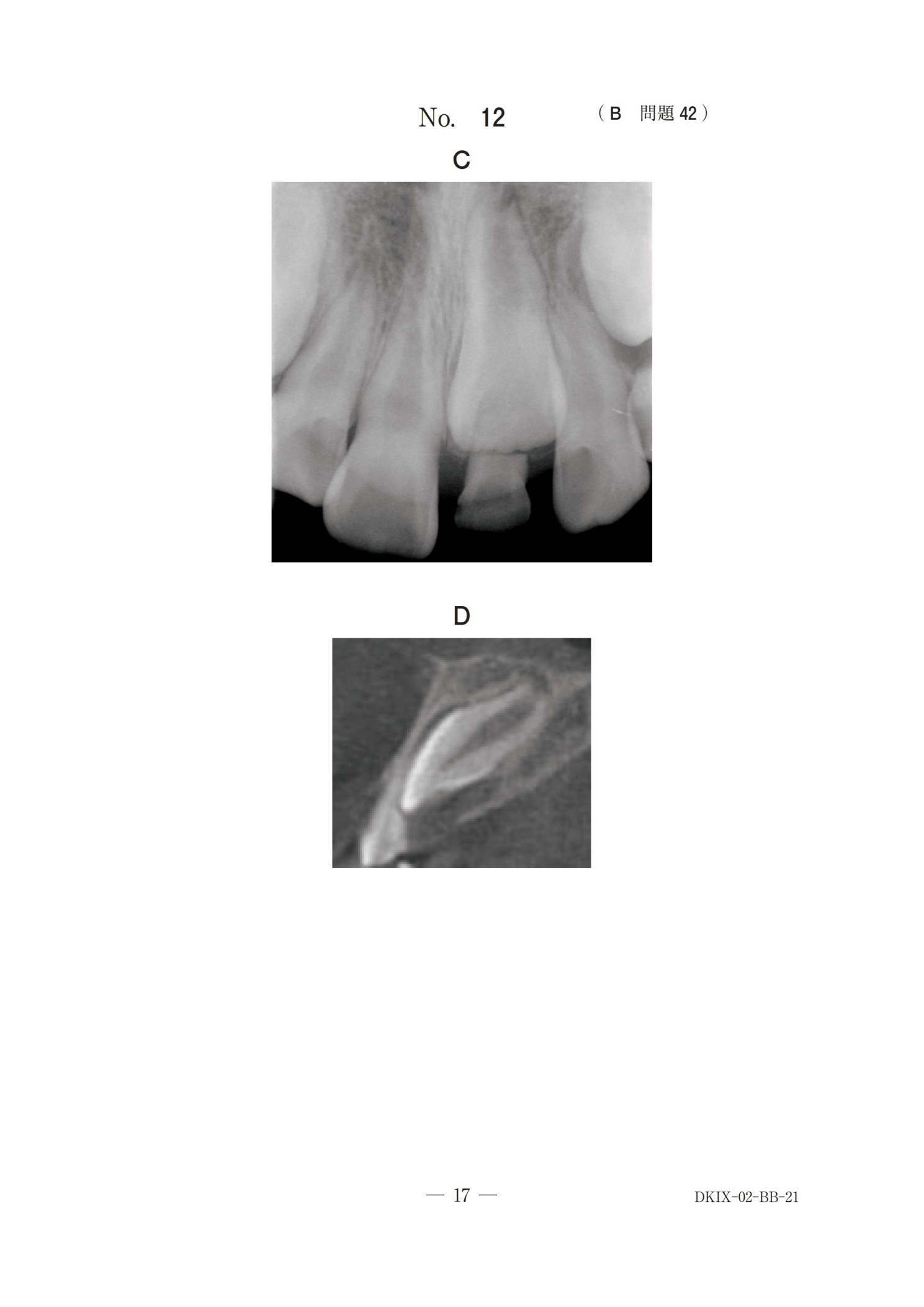118B 別冊 No.12（原本の見出し・A/B等ラベルを含む）