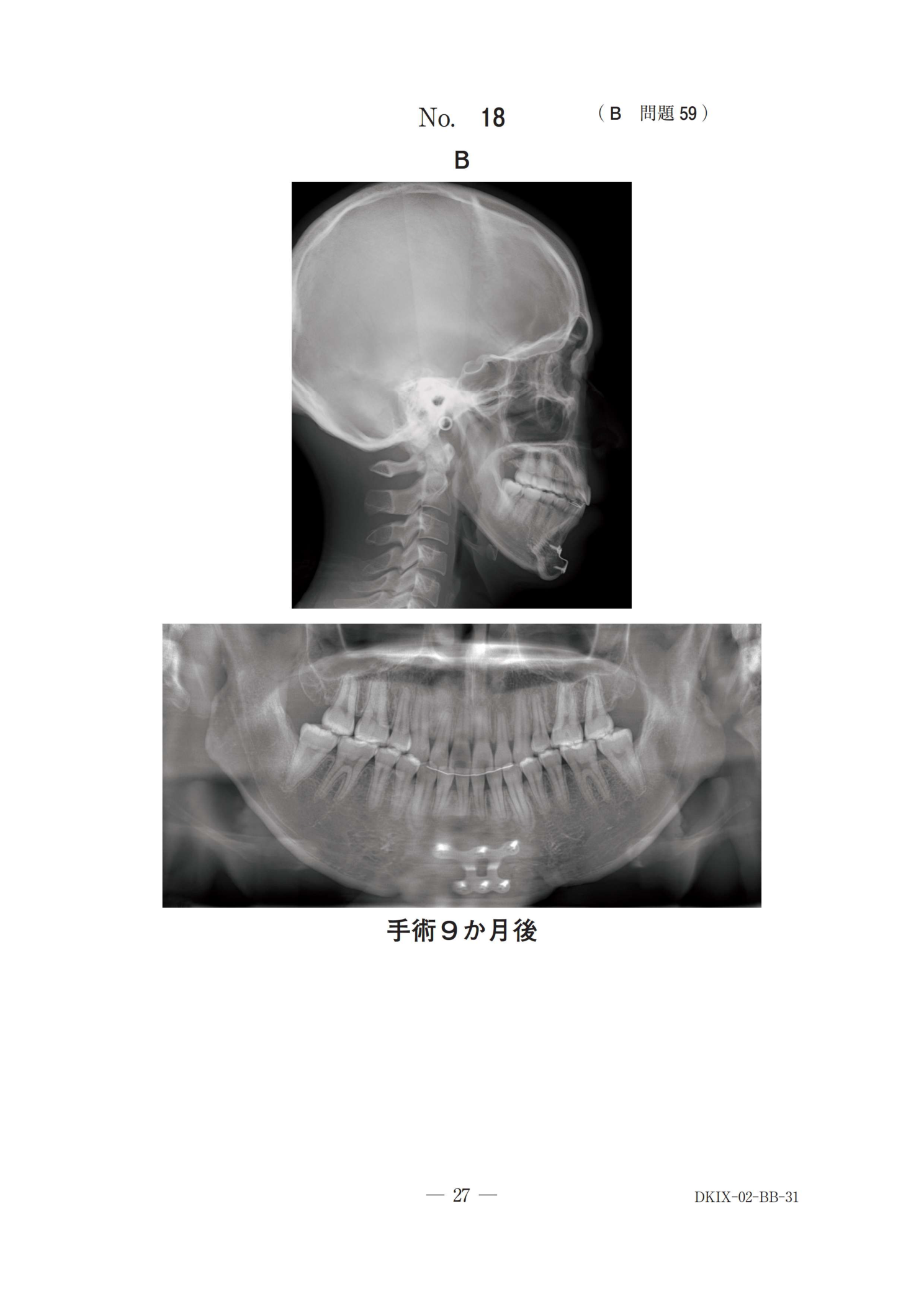 118B 別冊 No.18（原本の見出し・A/B等ラベルを含む）